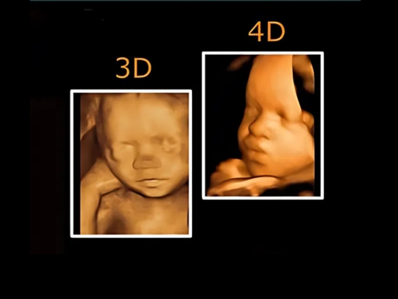3D/4D Ultrasound